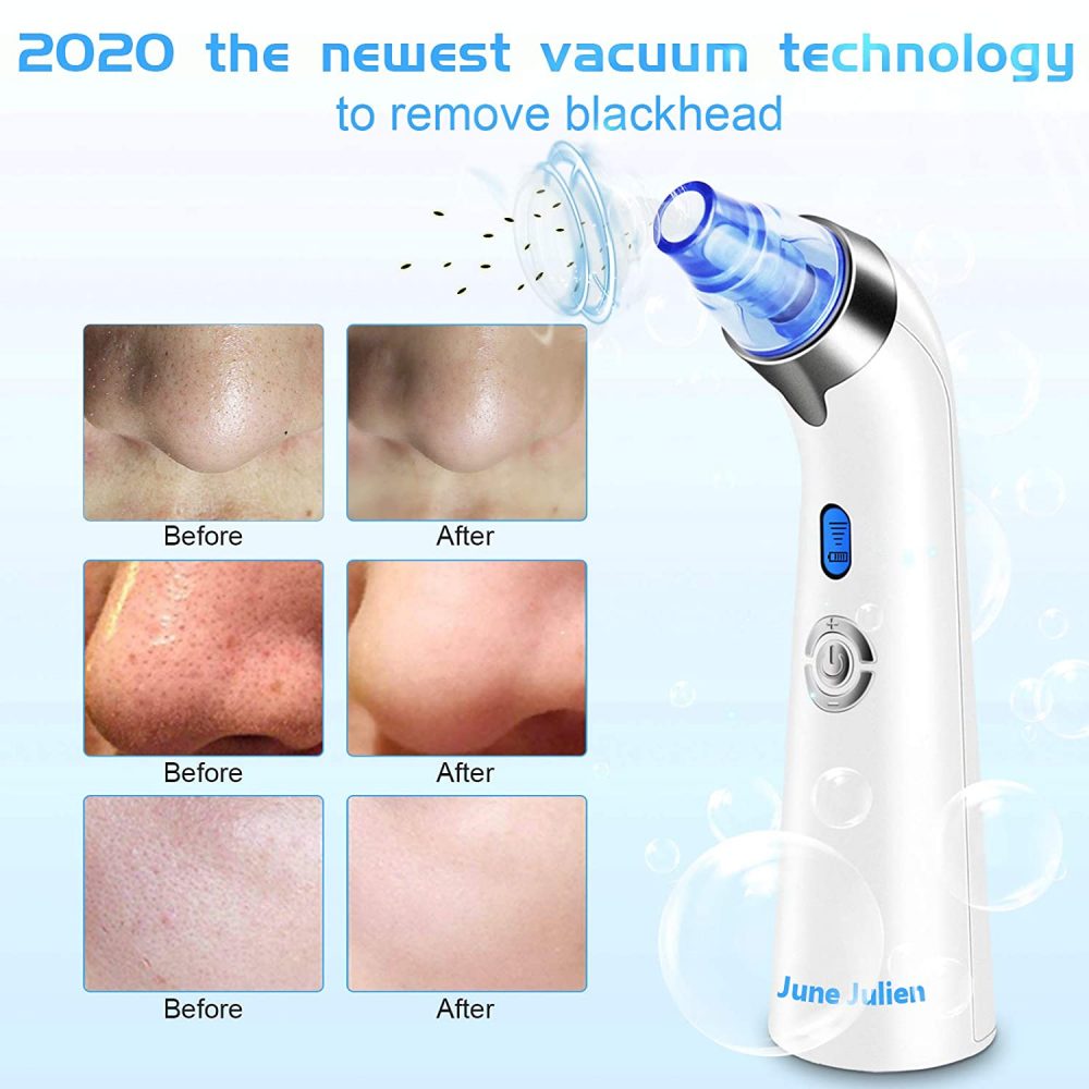 Best Pore Vacuum For Removing Blackheads